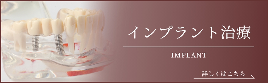 インプラント治療